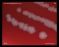 escherichia coli
